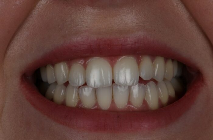 After - Cheadle Hulme Dental