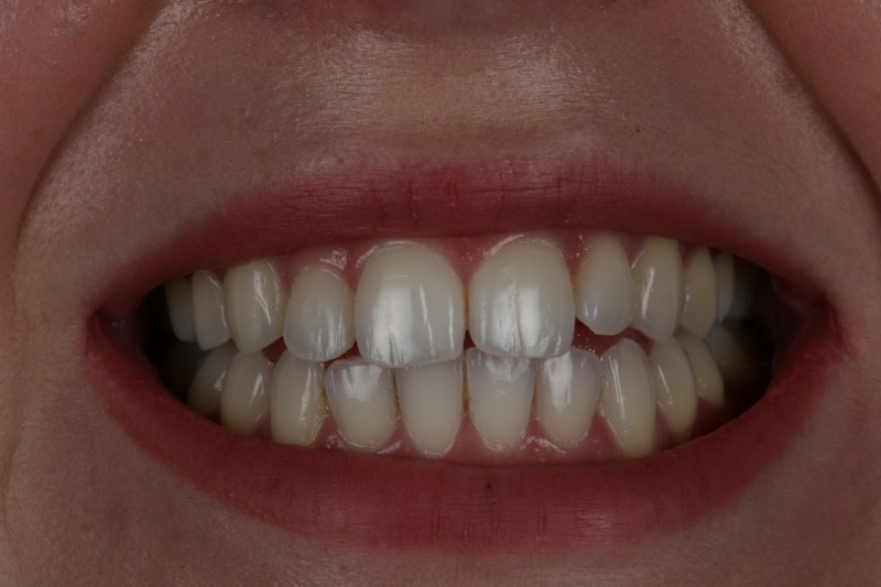 After - Cheadle Hulme Dental
