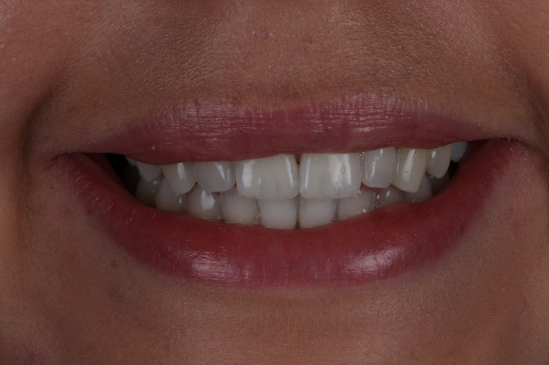 After - Cheadle Hulme Dental