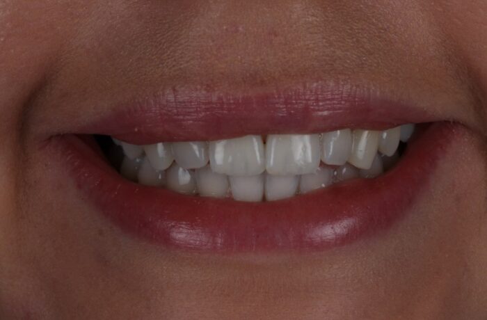 After - Cheadle Hulme Dental