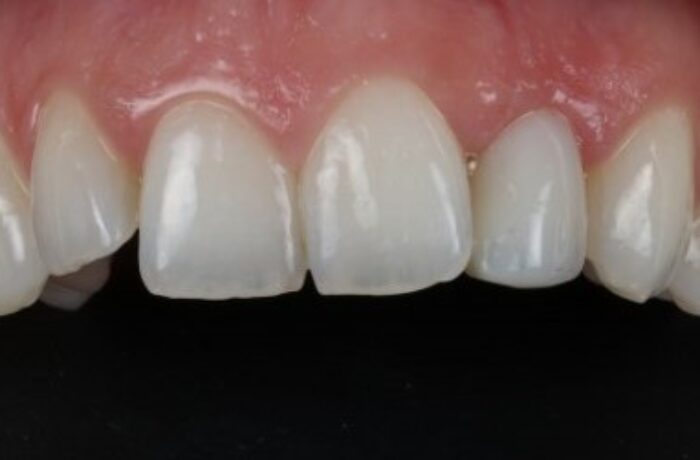 After - Cheadle Hulme Dental