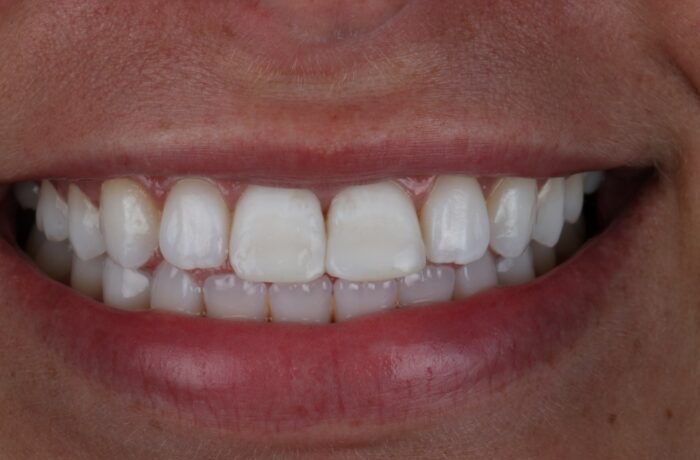 After - Cheadle Hulme Dental