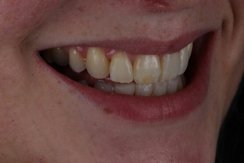 After - Cheadle Hulme Dental