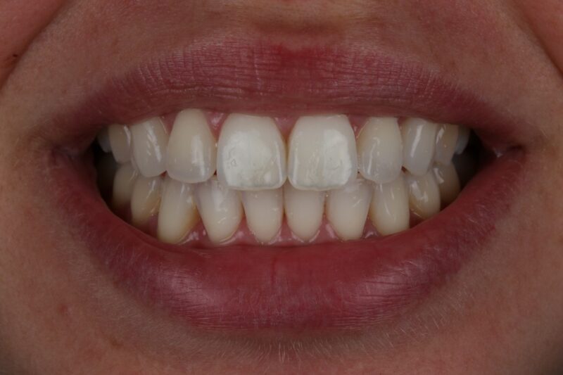 After - Cheadle Hulme Dental