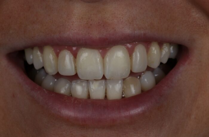 After - Cheadle Hulme Dental