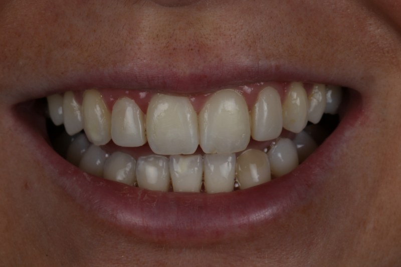 After - Cheadle Hulme Dental