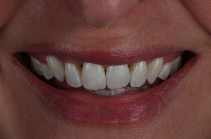 After - Cheadle Hulme Dental