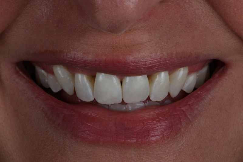After - Cheadle Hulme Dental