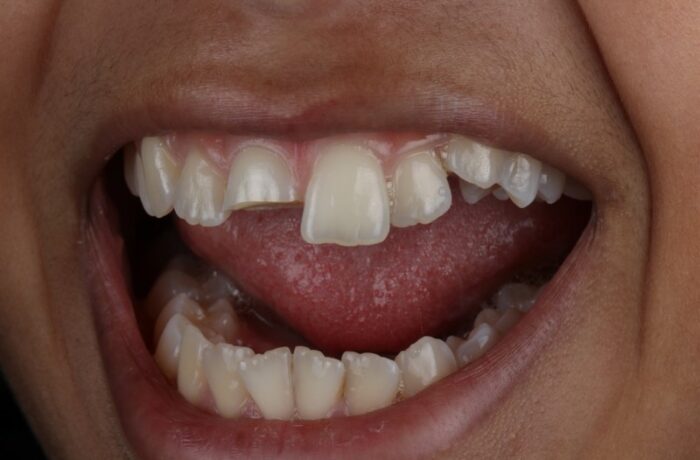 Before - Cheadle Hulme Dental