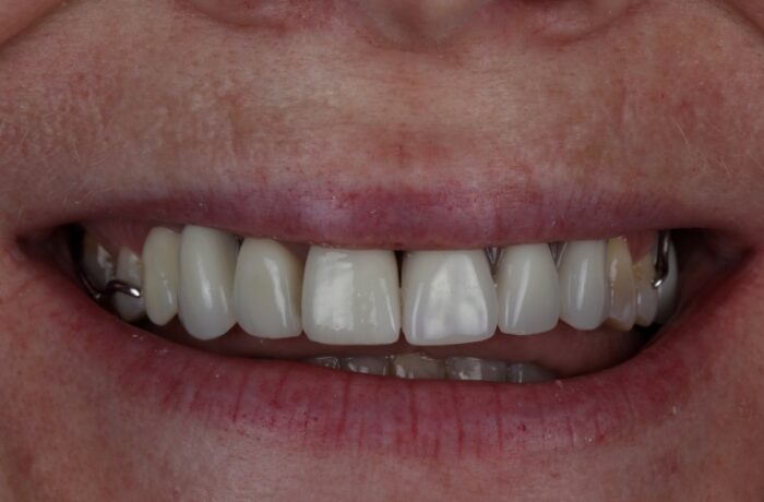 After - Cheadle Hulme Dental