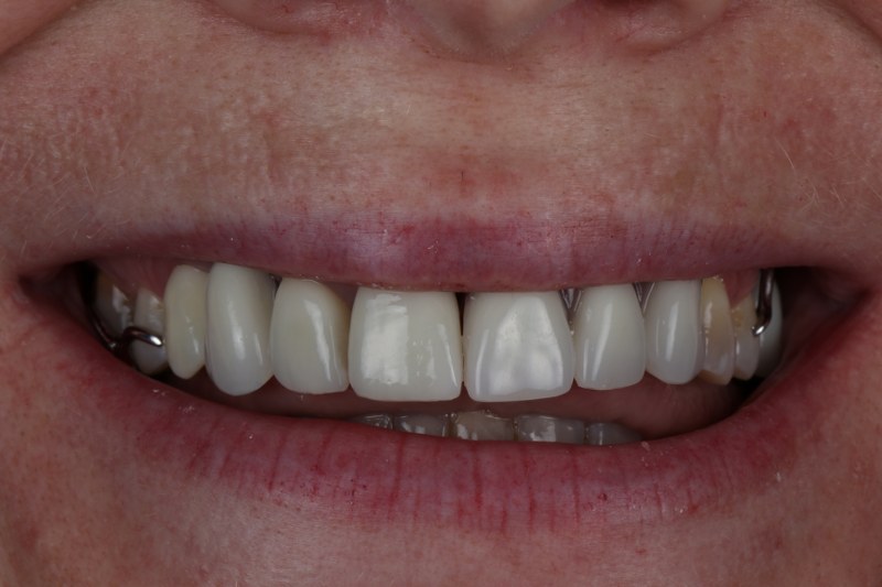 After - Cheadle Hulme Dental