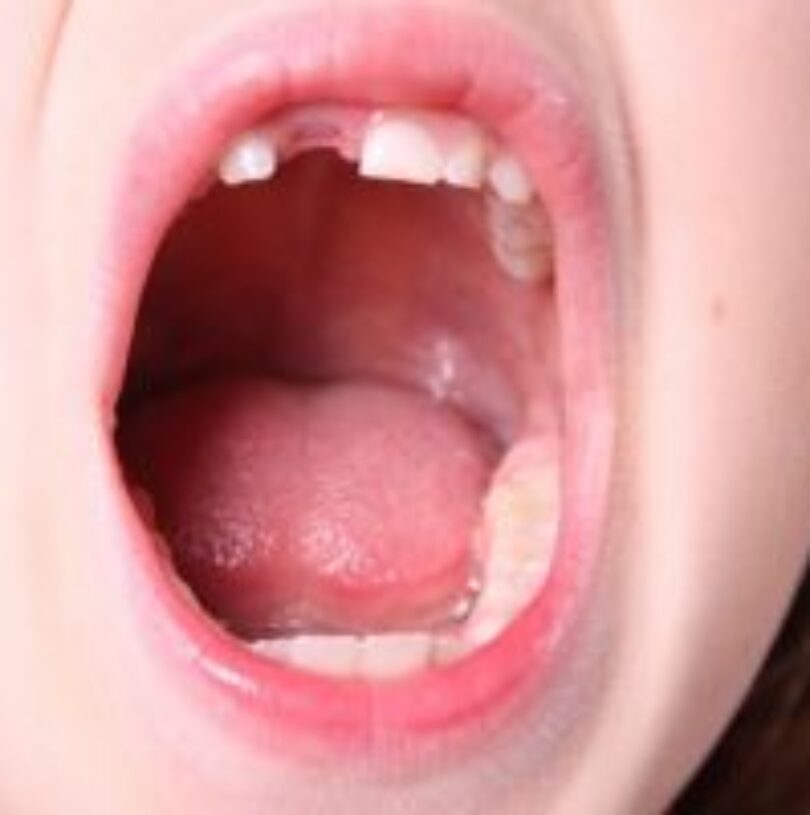 blog - Cheadle Hulme Dental