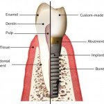 dental-implant-anatomy-150x150