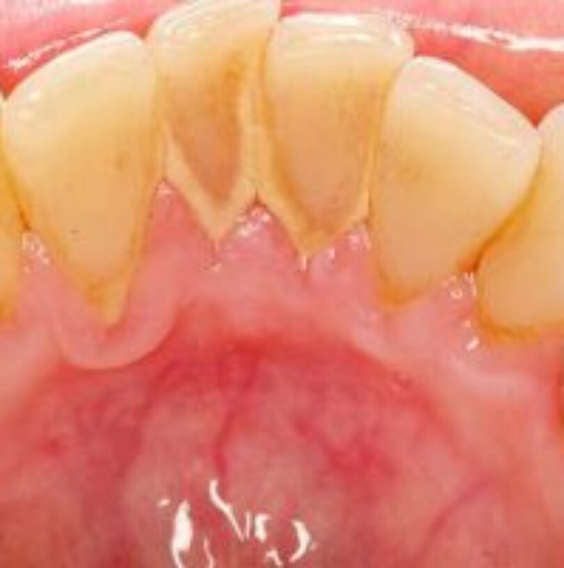 blog - Cheadle Hulme Dental