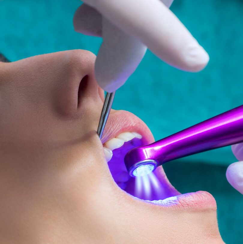 blog - Cheadle Hulme Dental