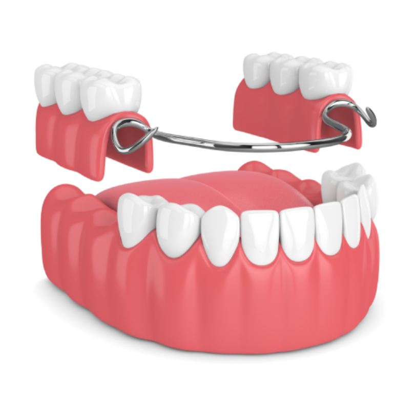 blog - Cheadle Hulme Dental