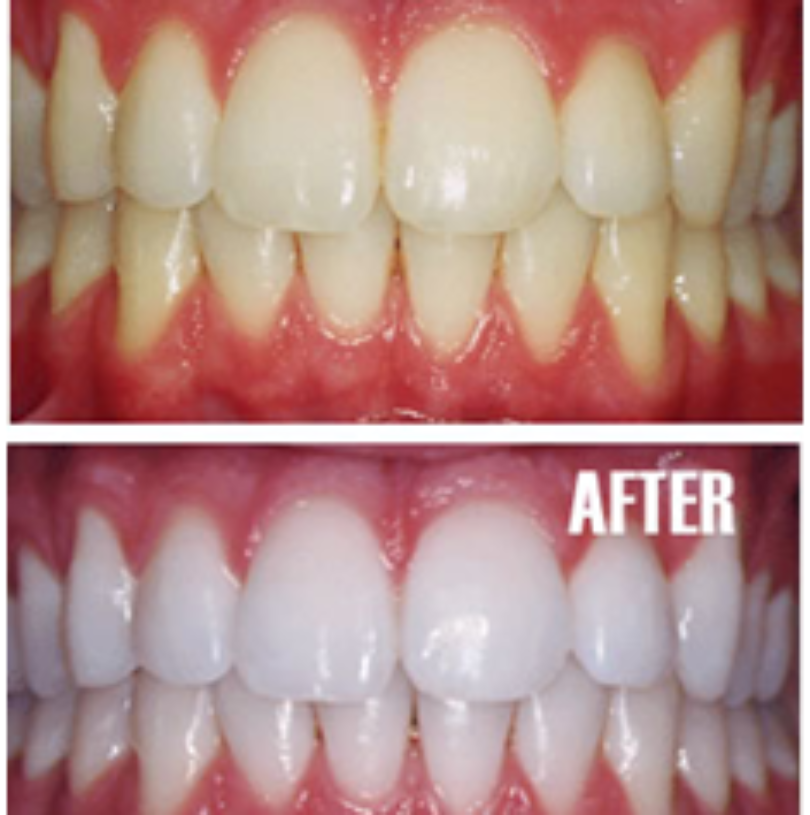 blog - Cheadle Hulme Dental