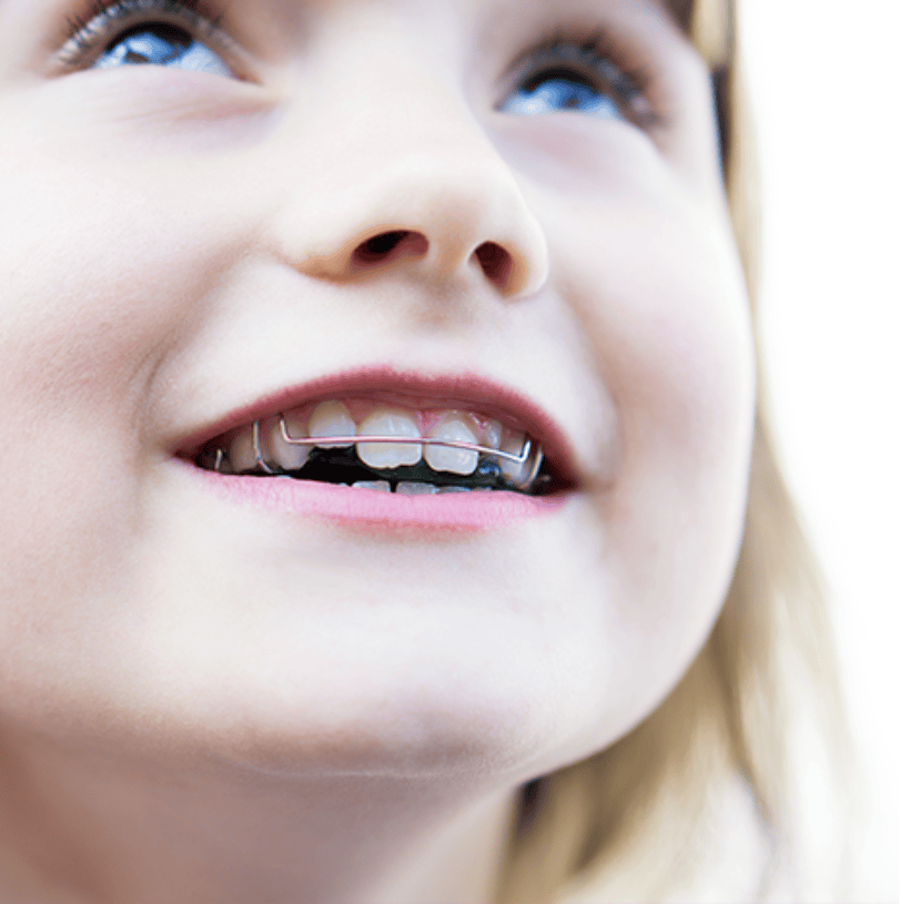 blog - Cheadle Hulme Dental