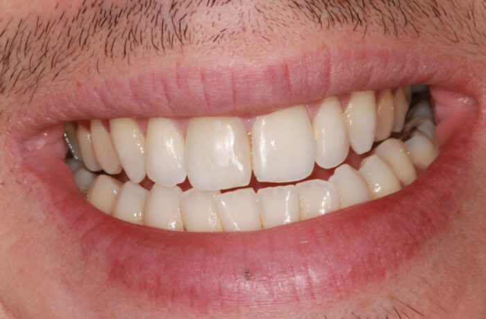 After - Cheadle Hulme Dental