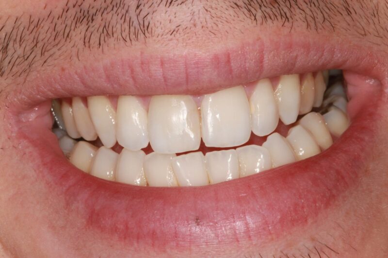 After - Cheadle Hulme Dental