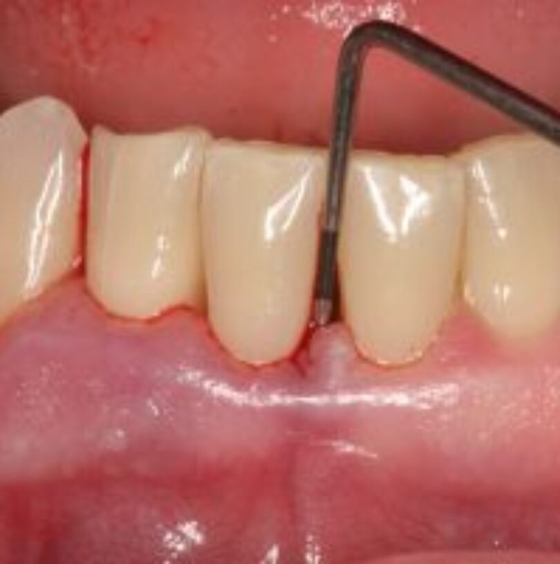 blog - Cheadle Hulme Dental