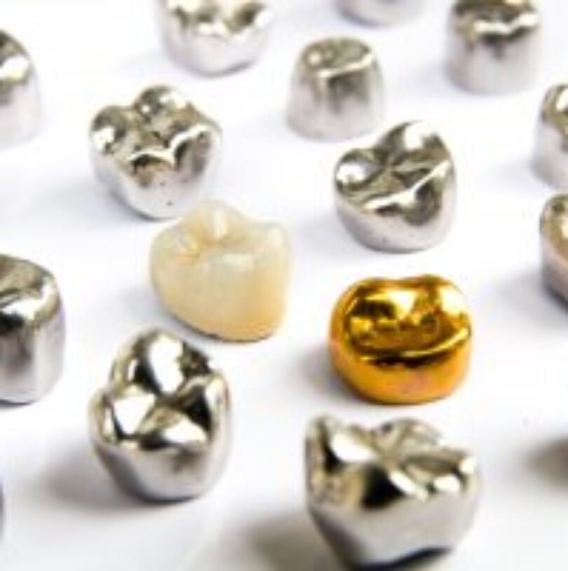 blog - Cheadle Hulme Dental