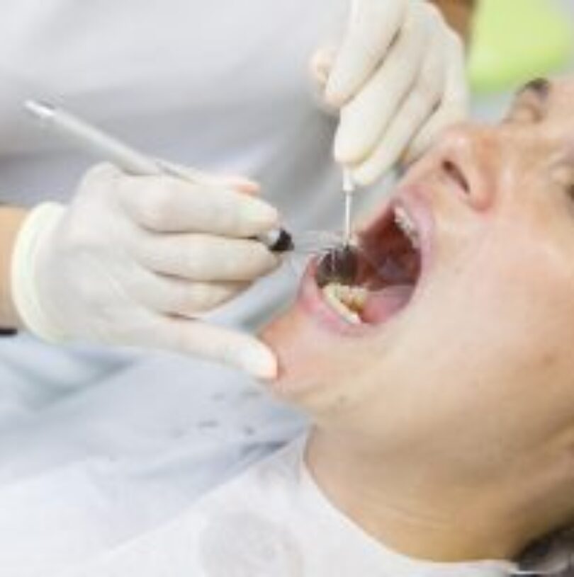 blog - Cheadle Hulme Dental