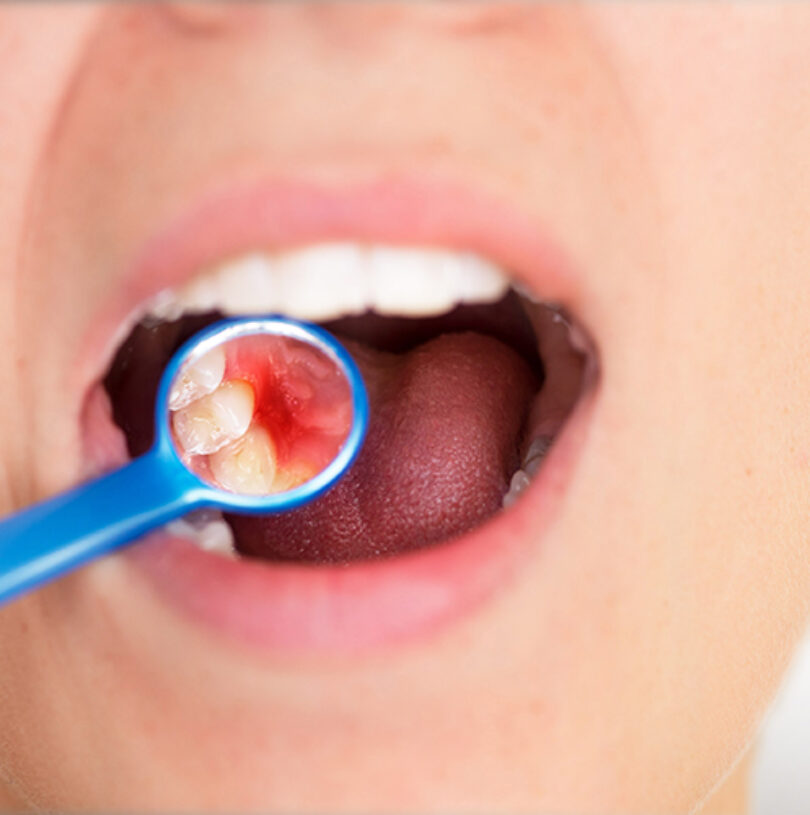blog - Cheadle Hulme Dental