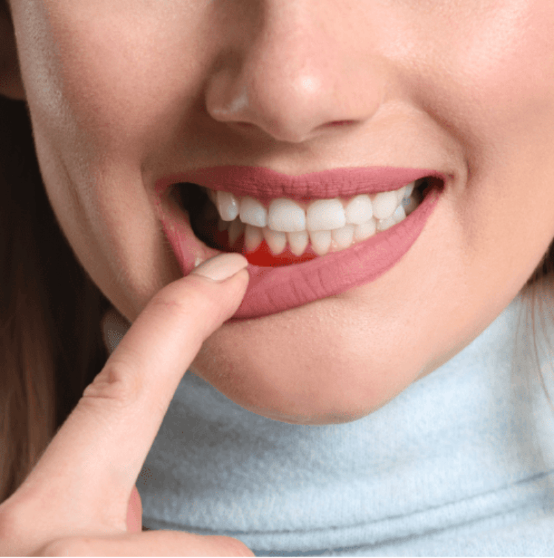 blog - Cheadle Hulme Dental