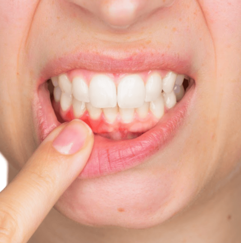 blog - Cheadle Hulme Dental