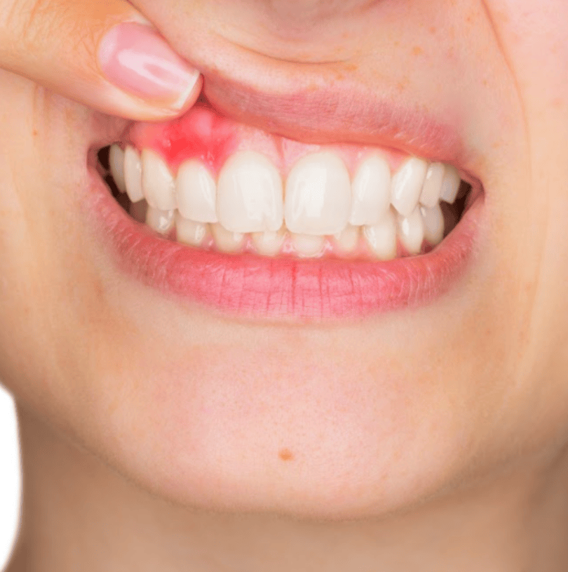 blog - Cheadle Hulme Dental