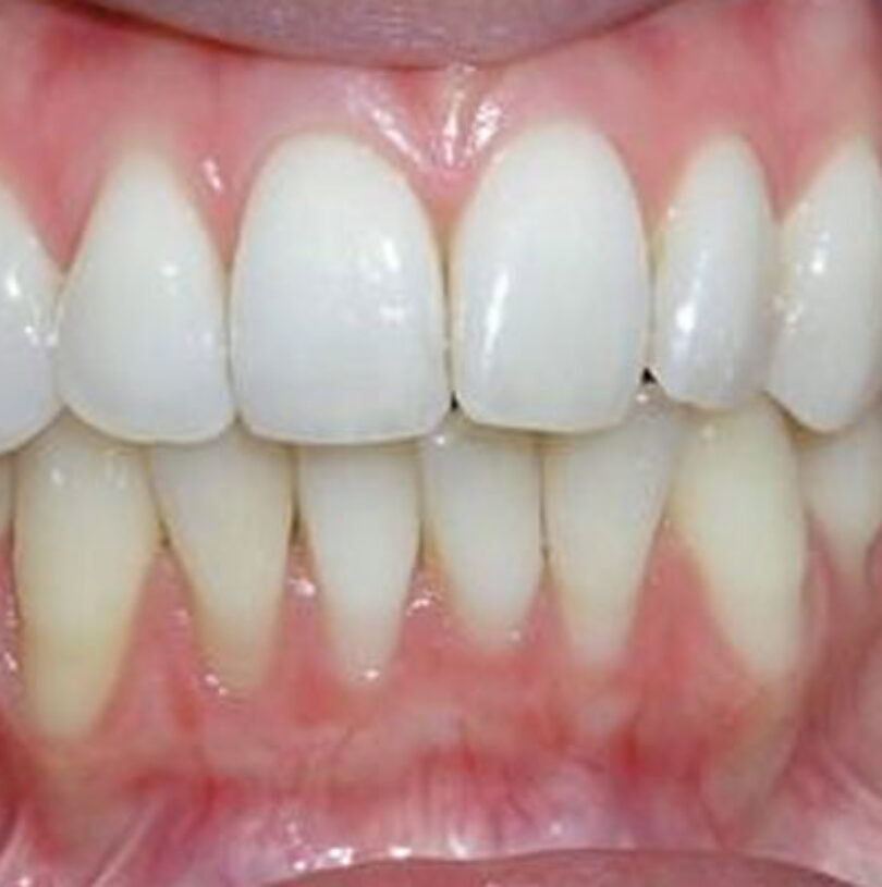 blog - Cheadle Hulme Dental