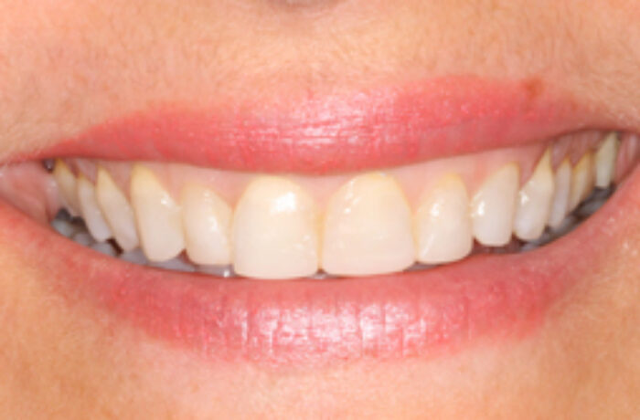 After - Cheadle Hulme Dental