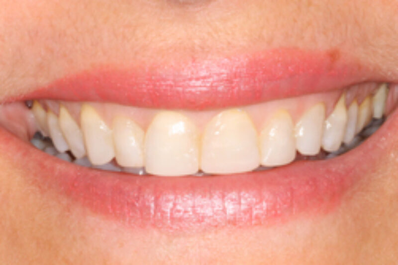 After - Cheadle Hulme Dental