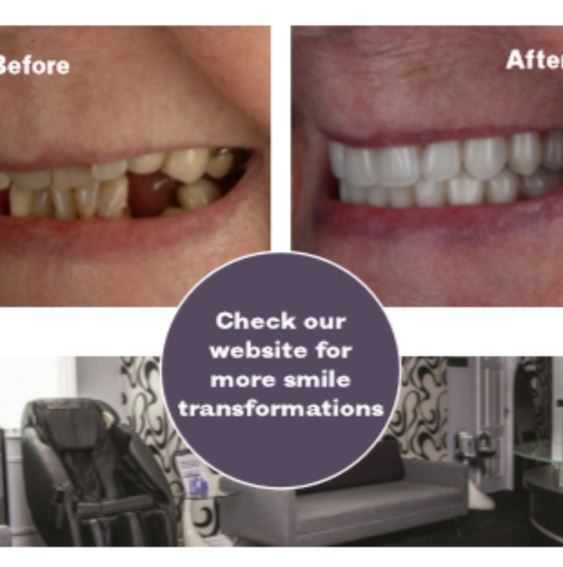 blog - Cheadle Hulme Dental