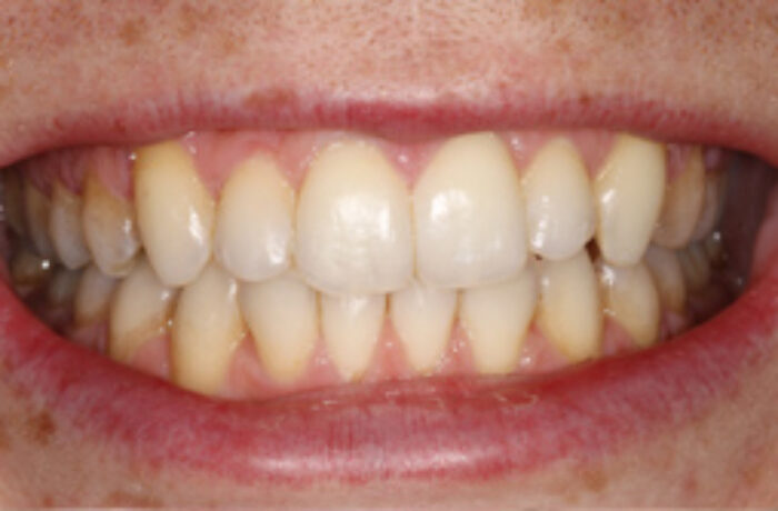 After - Cheadle Hulme Dental