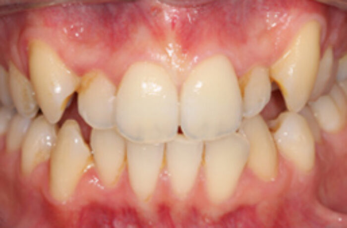 Before - Cheadle Hulme Dental