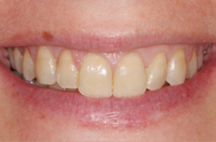 After - Cheadle Hulme Dental
