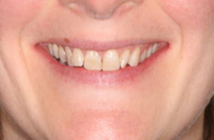 Before - Cheadle Hulme Dental