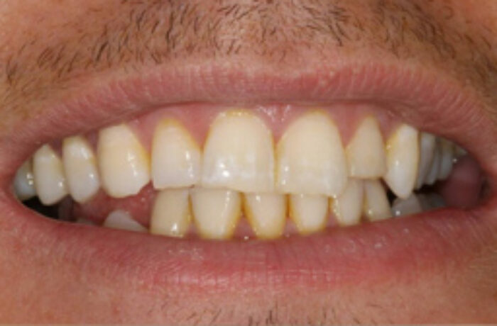 Before - Cheadle Hulme Dental