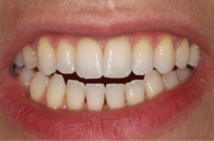 After - Cheadle Hulme Dental