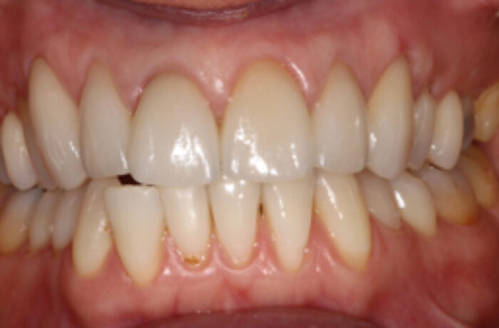 After - Cheadle Hulme Dental