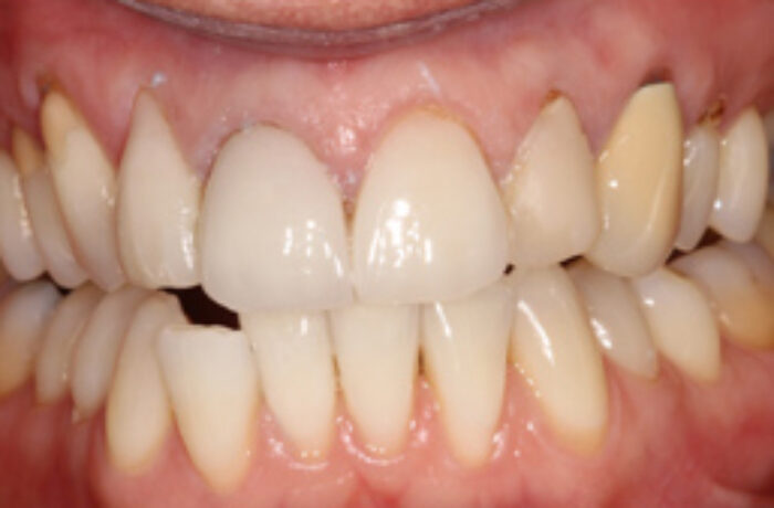 Before - Cheadle Hulme Dental