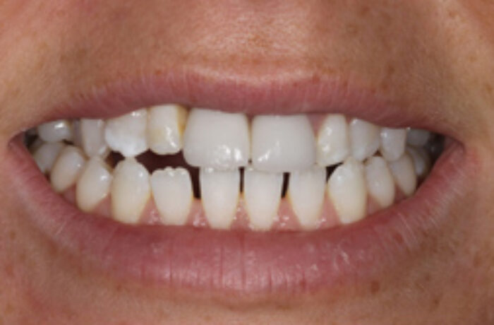 After - Cheadle Hulme Dental