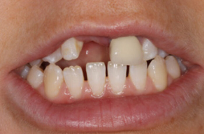 Before - Cheadle Hulme Dental