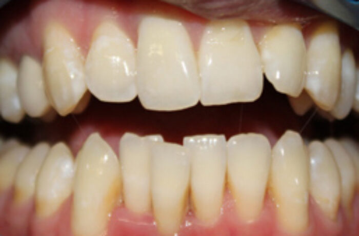 Before - Cheadle Hulme Dental