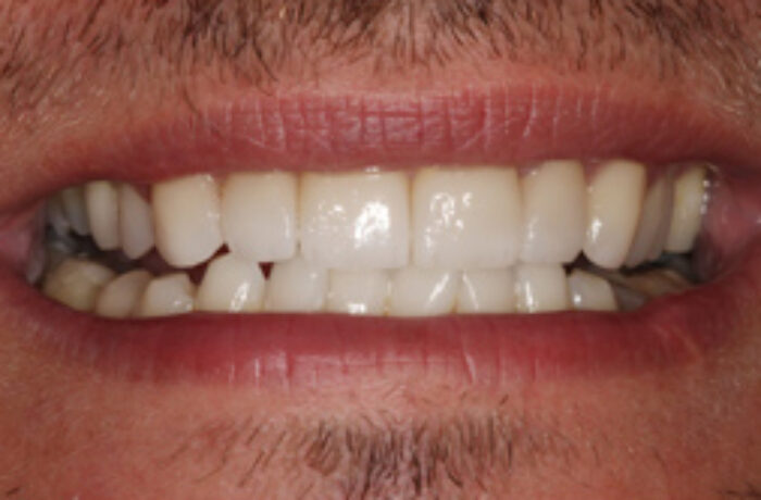 After - Cheadle Hulme Dental