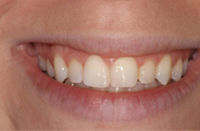 After - Cheadle Hulme Dental