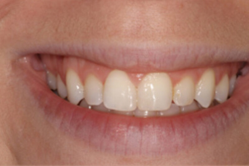 After - Cheadle Hulme Dental