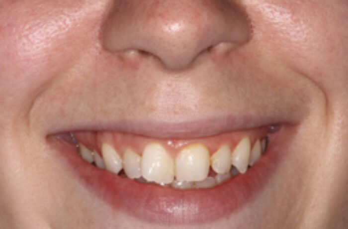 Before - Cheadle Hulme Dental